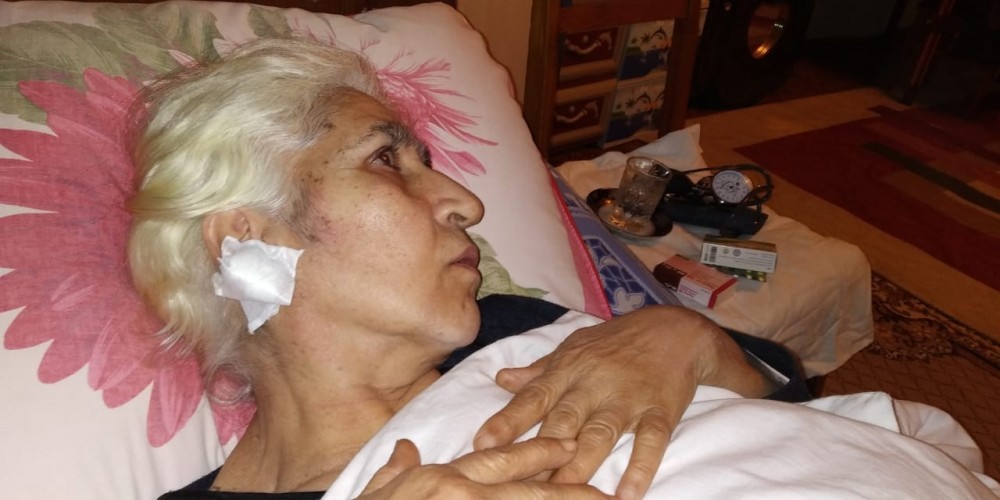 Ermənilər Ağdamı atəşə tutdu: Yaşlı qadın yaralandı - FOTO