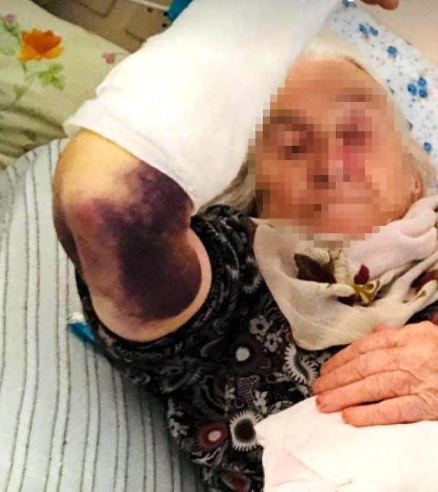 Gəlin 92 yaşlı qayınanasını döyüb, qolunu qırdı - FOTO + VİDEO