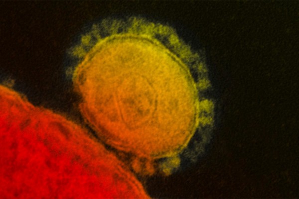 Bu ölkədə koronavirusa yoluxanların sayı ARTDI