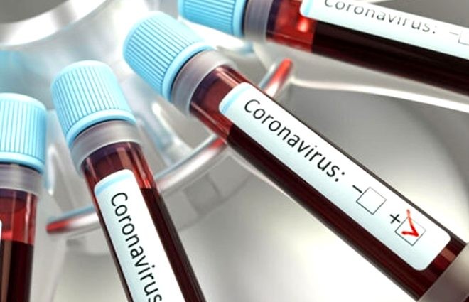 Koronavirus ən çox bu xəstəliyi olan şəxsləri öldürür