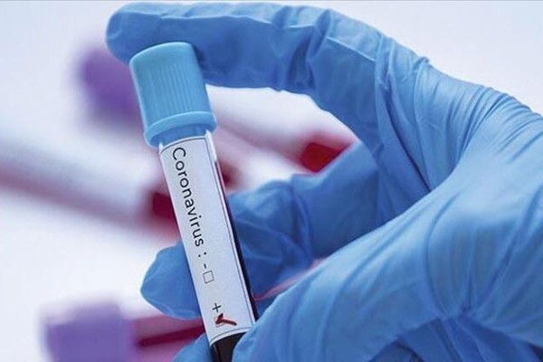 Azərbaycanda koronavirusdan daha bir nəfər öldü: 104 yeni yoluxma