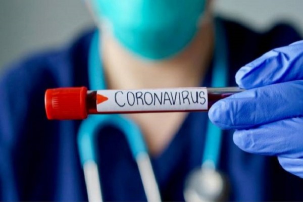 Diplomatlar arasında koronavirusa yoluxan yoxdur 