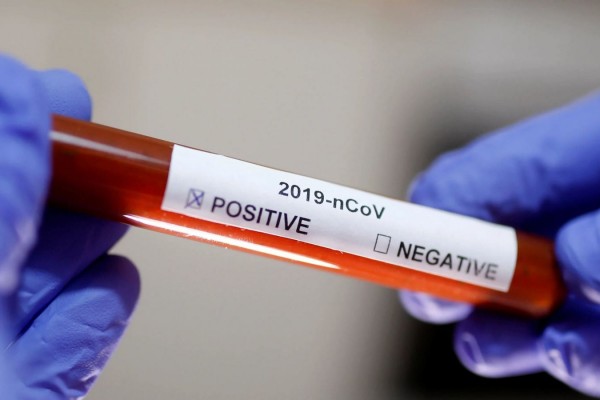 ABŞ-da bir gündə 400 nəfər koronavirusdan öldü