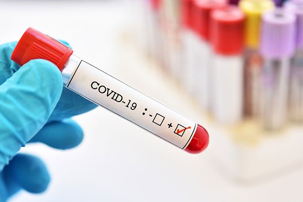 Bu gün Azərbaycanda 6887 nəfər koronavirus testindən keçib 