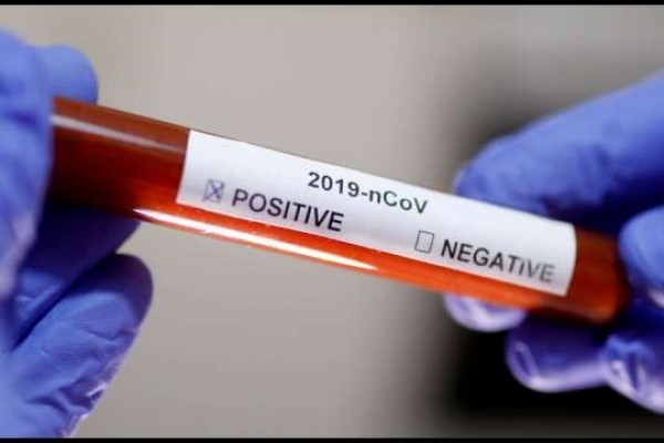 Rusiya koronavirus peyvəndininistehsalını planlaşdırır