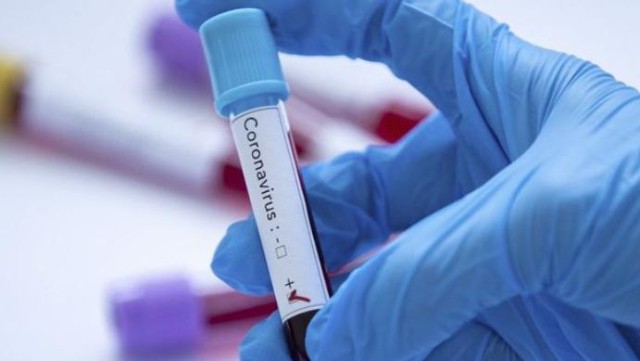 7 jurnalist koronavirusa yoluxdu - Qazaxıstanda