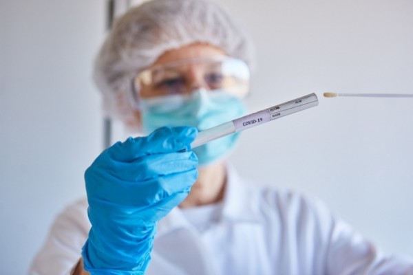 Ölkədə koronavirusla bağlı testlərin sayı açıqlandı - RƏSMİ