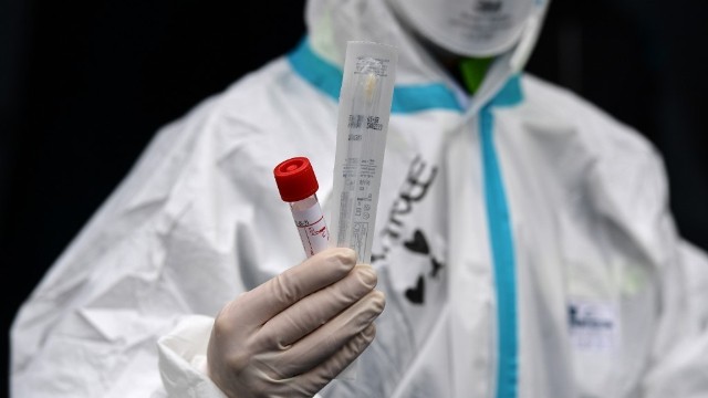 Azərbaycanda daha 537 nəfər koronavirusa yoluxdu -7 nəfər öldü