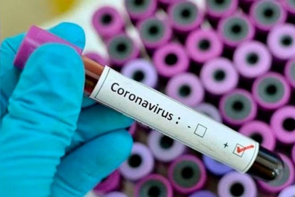 Rusiyada koronavirusa yoluxanların sayı 720 mini keçdi 
