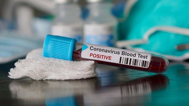 Bu ölkədə koronavirus vaksininin insanlar üzərində sınaqları başladı 