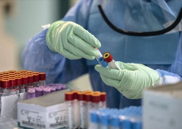 Rusiyada koronavirusa yoluxanların sayı açıqlandı 
