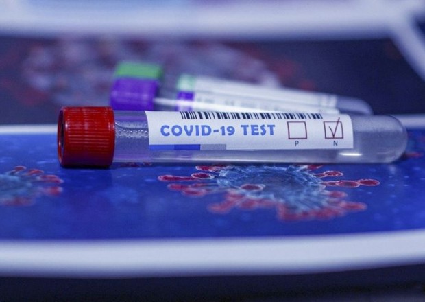Azərbaycanda indiyədək aparılan koronavirus testlərinin sayı açıqlandı 