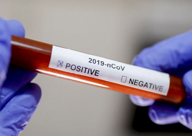 İranda son sutkada koronavirusdan 232 nəfər vəfat etdi 