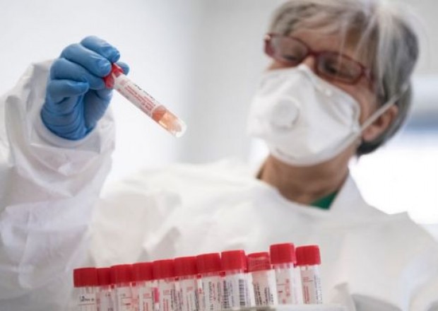 Azərbaycanda indiyədək aparılan koronavirus testinin sayı açıqlandı