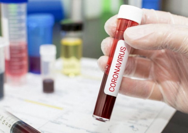Rusiyada koronavirusdan ölüm sayı 86 mini ötdü 