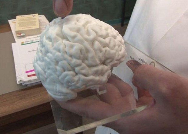 Türkiyədə printerlə insan beyni hazırlandı