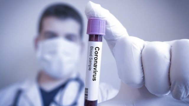 Koronavirusun daha bir təhlükəli simptomu açıqlandı