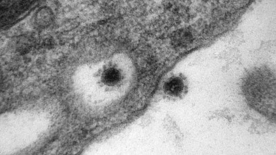 Koronavirusun delta ştammınınfotosu dərc olundu