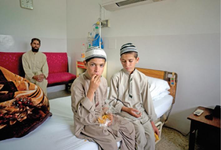  Tibbin aciz qaldığı Pakistanlı Günəşli oğlanlar - VİDEO