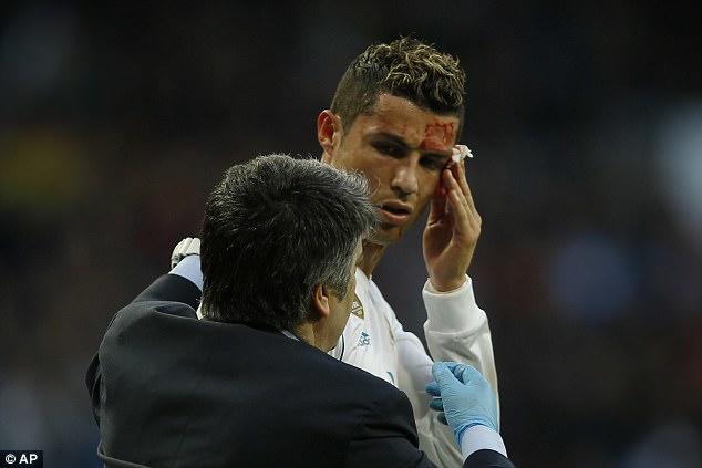 Ronaldo qan içində qaldı   - FOTO