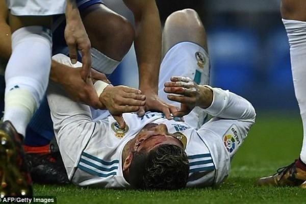 Ronaldo qan içində qaldı   - FOTO