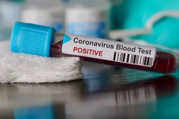 Koronavirus testi pozitiv çıxan həkim intihar etdi 