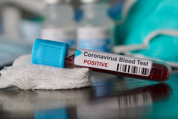 Ölkədə koronavirusa yoluxanların sayı 600-ə çatır 