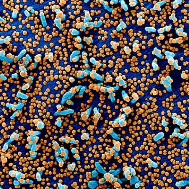 Koronavirusun insan bədənində necə yayılması görüntüləndi - FOTO+VİDEO