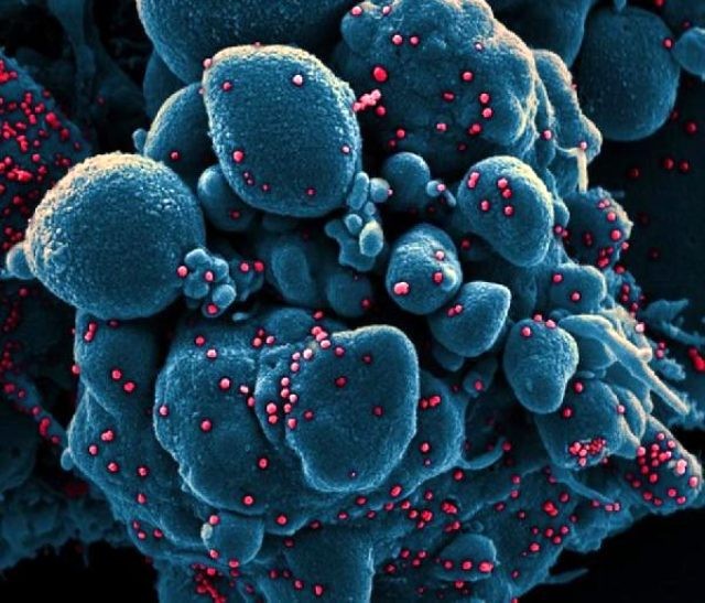 Koronavirusun insan bədənində necə yayılması görüntüləndi - FOTO+VİDEO