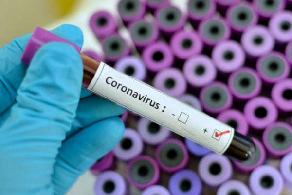 Ölkədə koronavirusa yoluxanların sayı 991-ə çatdı 