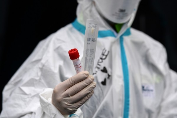 Azərbaycanda daha 248 nəfərdə koronavirus aşkarlandı,2 nəfər öldü