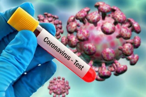 Koronavirusa yoluxan icra başçısının40 əməkdaşından test götürüldü