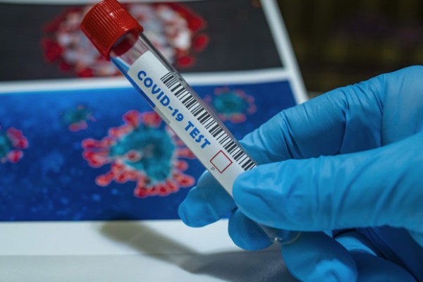 Rusiyada bir gündə 138 nəfər koronavirusdan öldü
