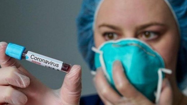 Azərbaycanda daha 352 nəfər koronavirusa yoluxdu- 2 nəfər vəfat etdi