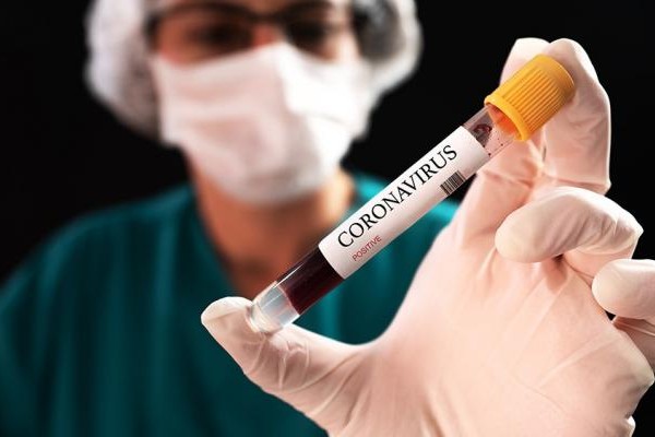 Koronavirus keçirənlərdə eşitmə zəifliyi yaranır 