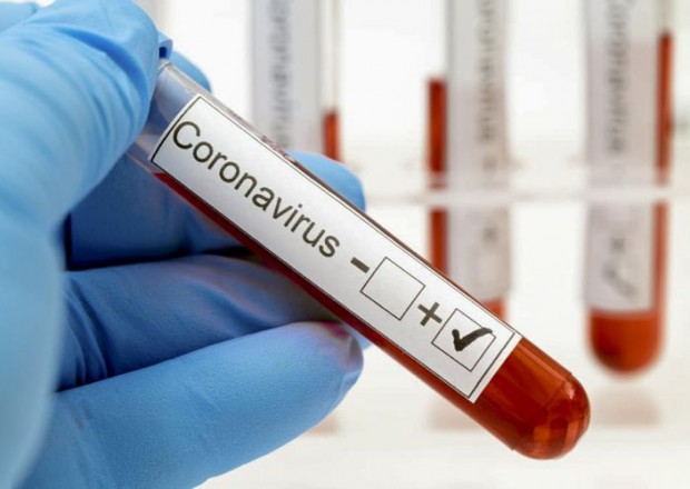 Rusiyada son sutkada 26 338 nəfər koronavirusa yoluxdu
