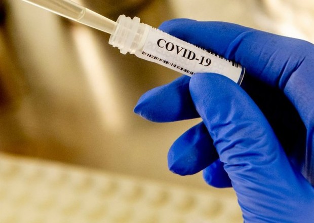 Dünyada COVID-19-dan ölənlərin sayı 4 milyonu keçdi 