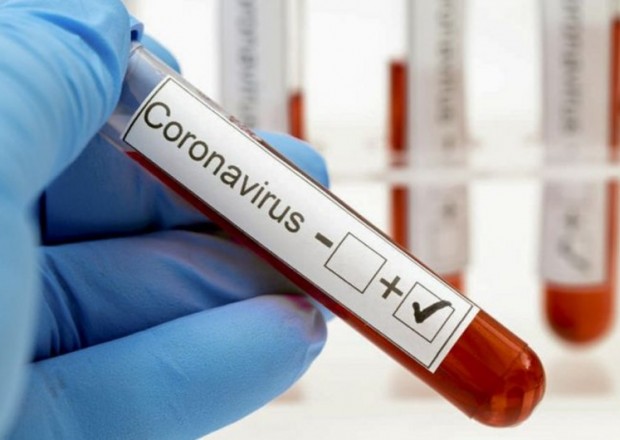 Gürcüstanda daha 952 nəfər koronavirusa yoluxub