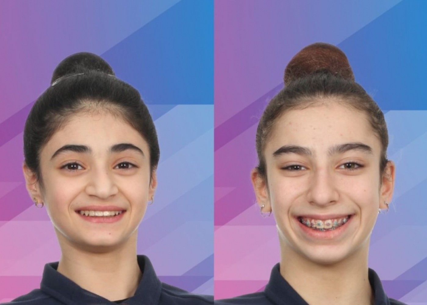 Azərbaycan gimnastları Almaniyada iki medal qazandı